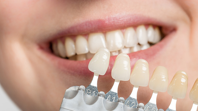 The image shows a person smiling with a set of dental implants being held up against their teeth, highlighting the appearance of the implants.